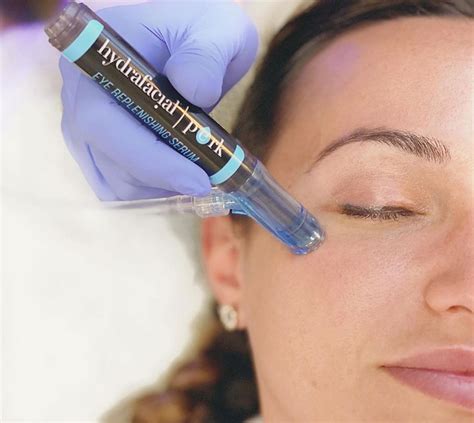 HydraFacial Perk Treatment Review .